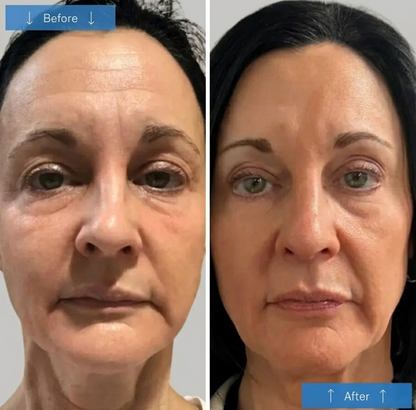 FirmFace Mask™