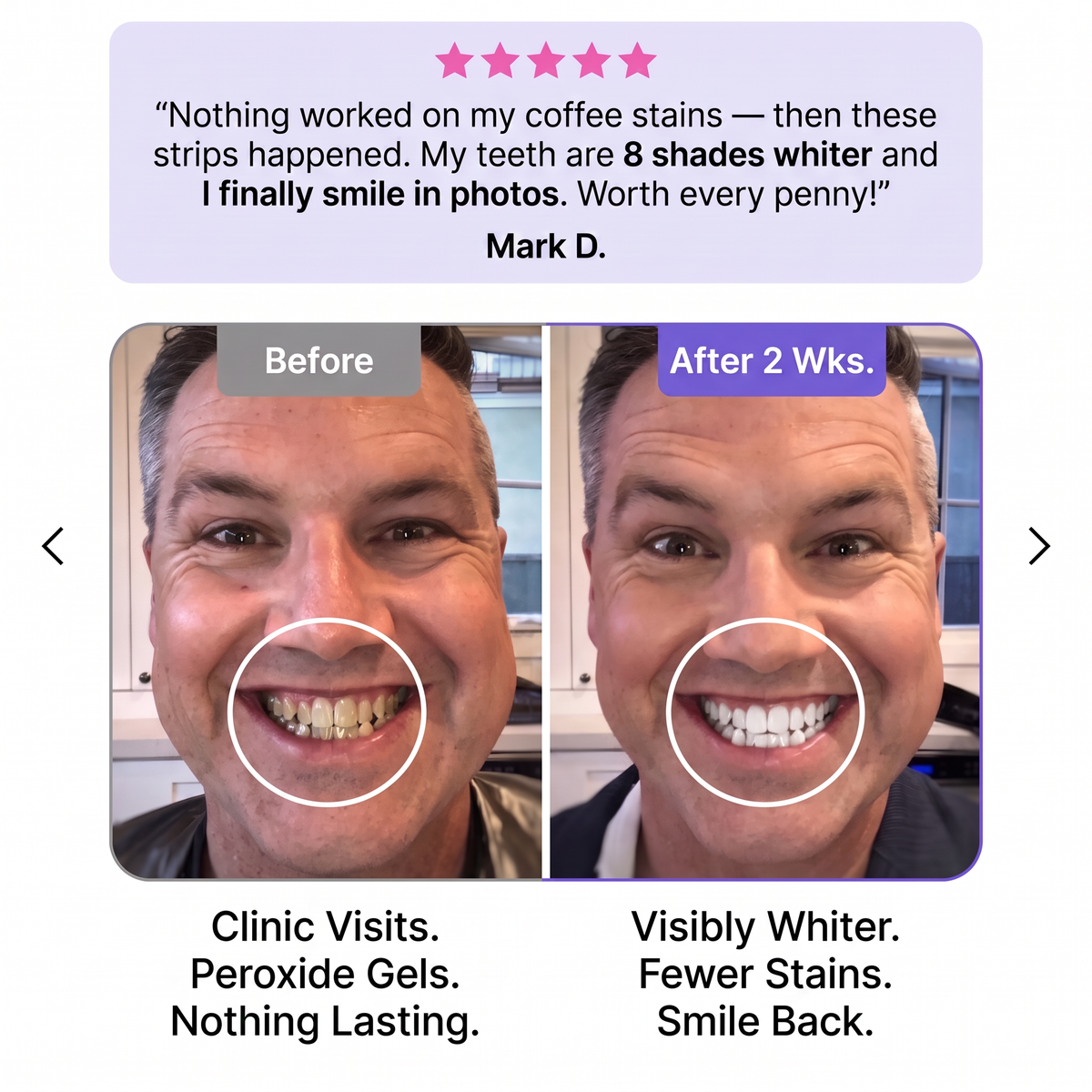 SmileUp Strips™ | Brighter Smile