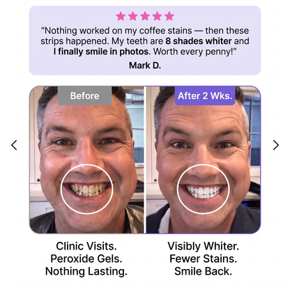 SmileUp Strips™ | Brighter Smile