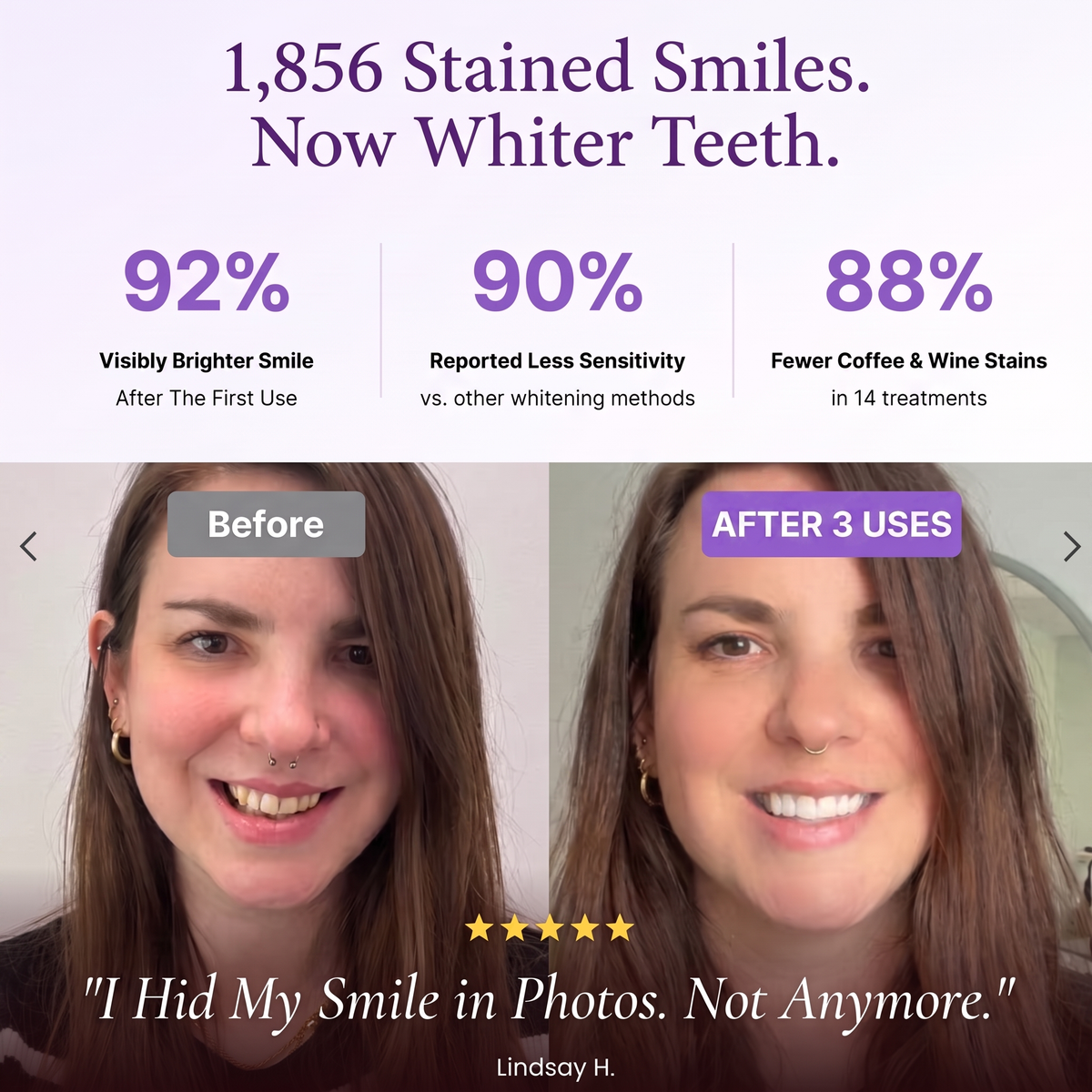 SmileUp Strips™ | Brighter Smile