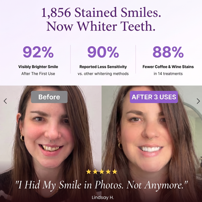 SmileUp Strips™ | Brighter Smile