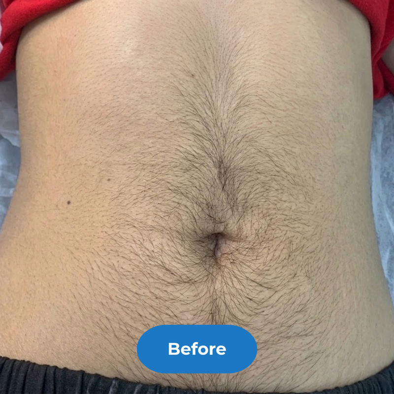 Stomach before treatment