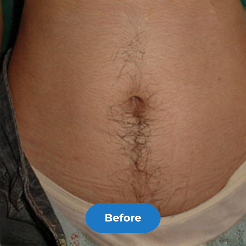 Stomach before treatment