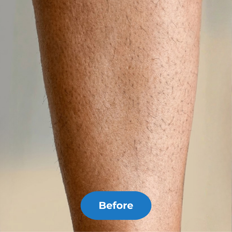 Legs before treatment