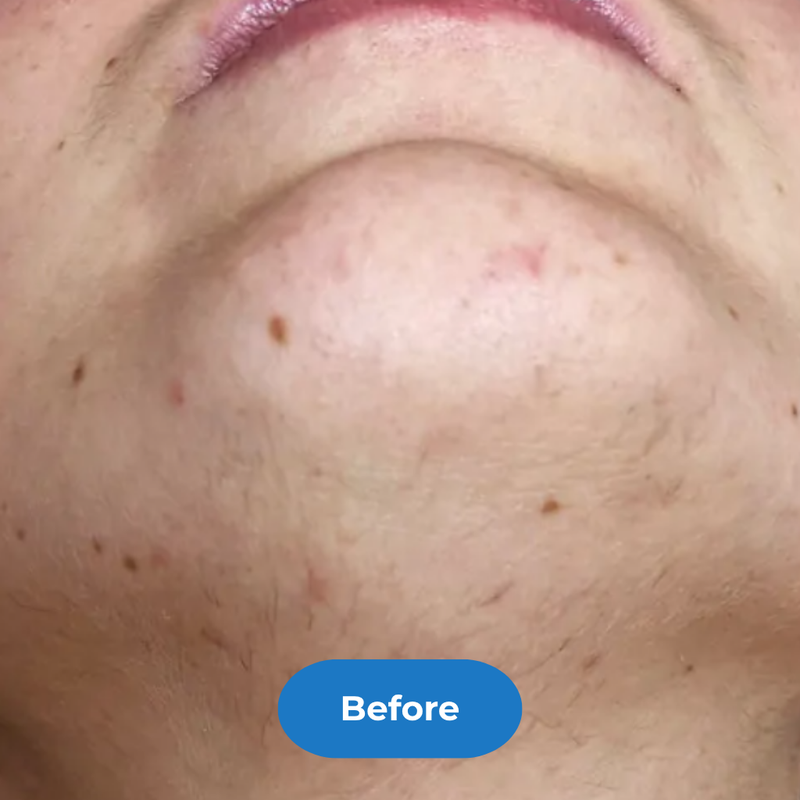 Face before treatment