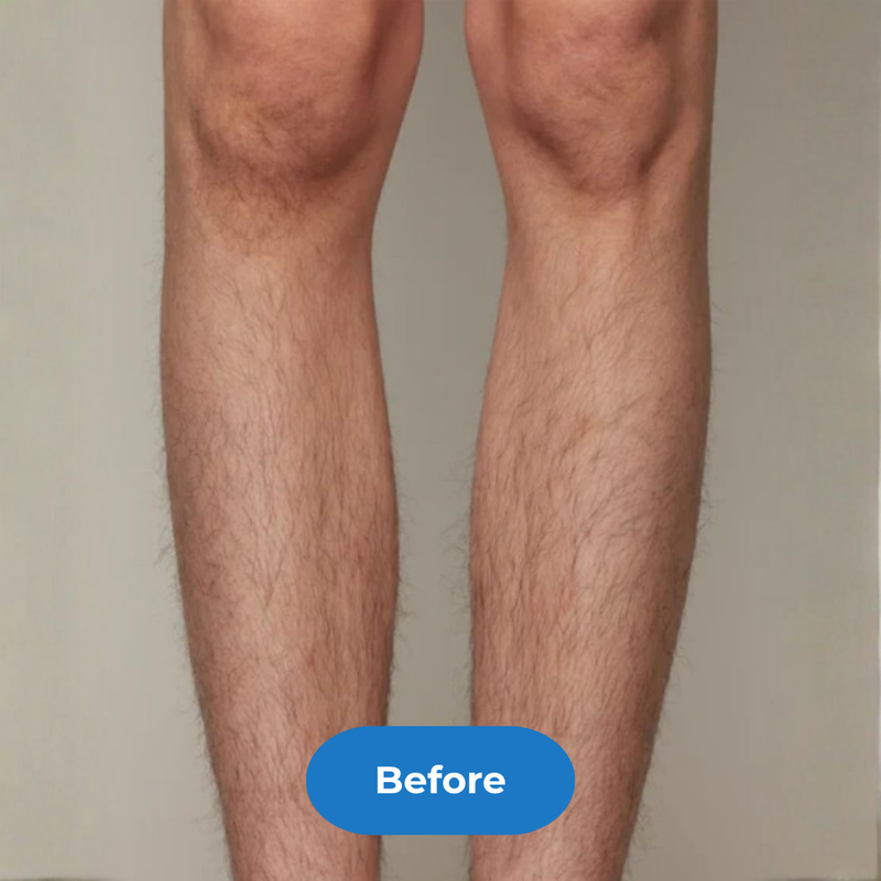 Legs before treatment