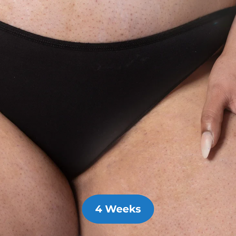Bikini after treatment