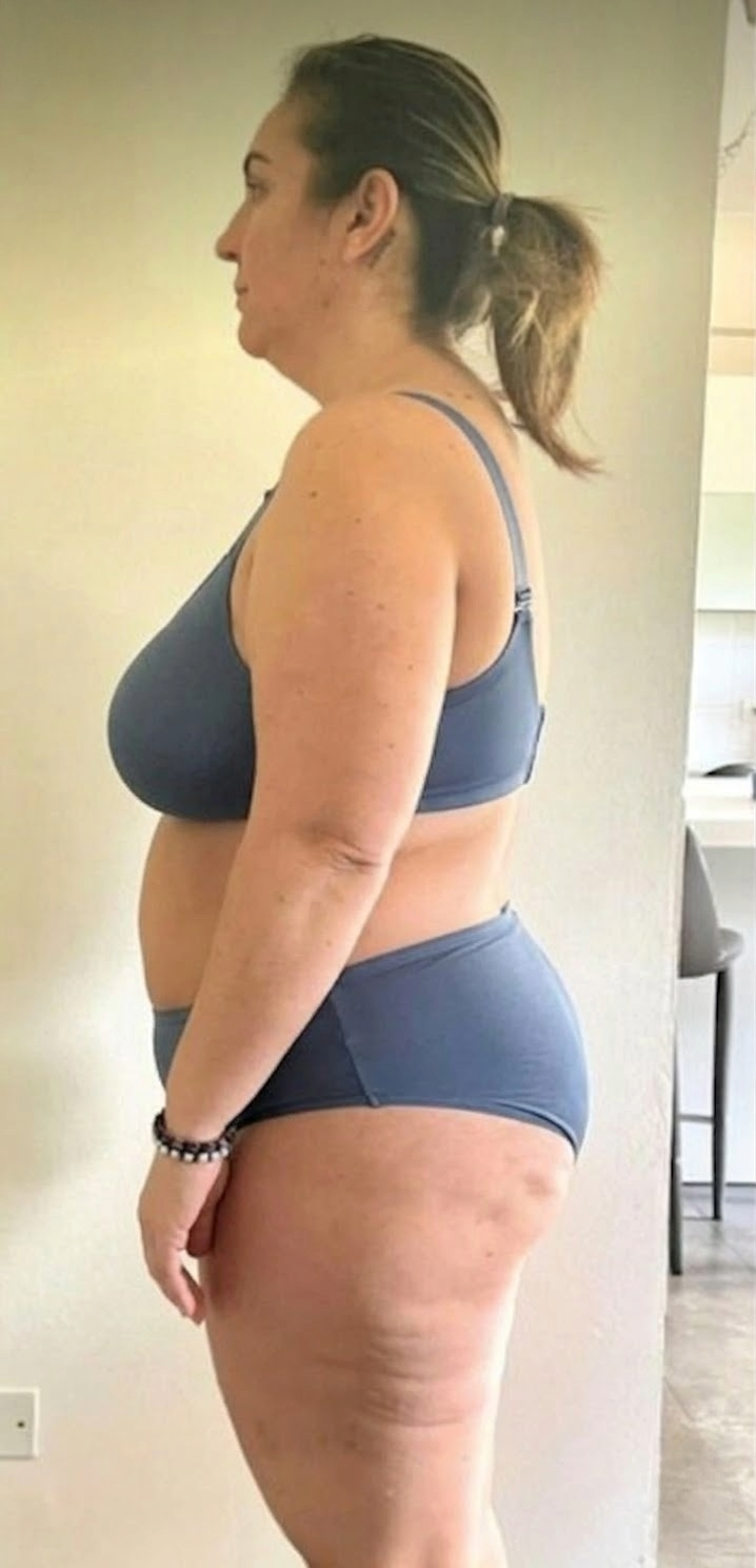 Before - Sara