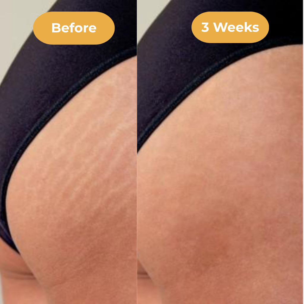 MarkEase Serum™