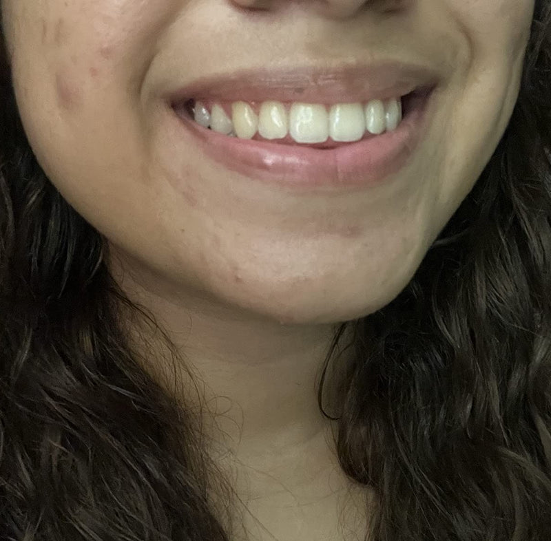 Before - Mila To.