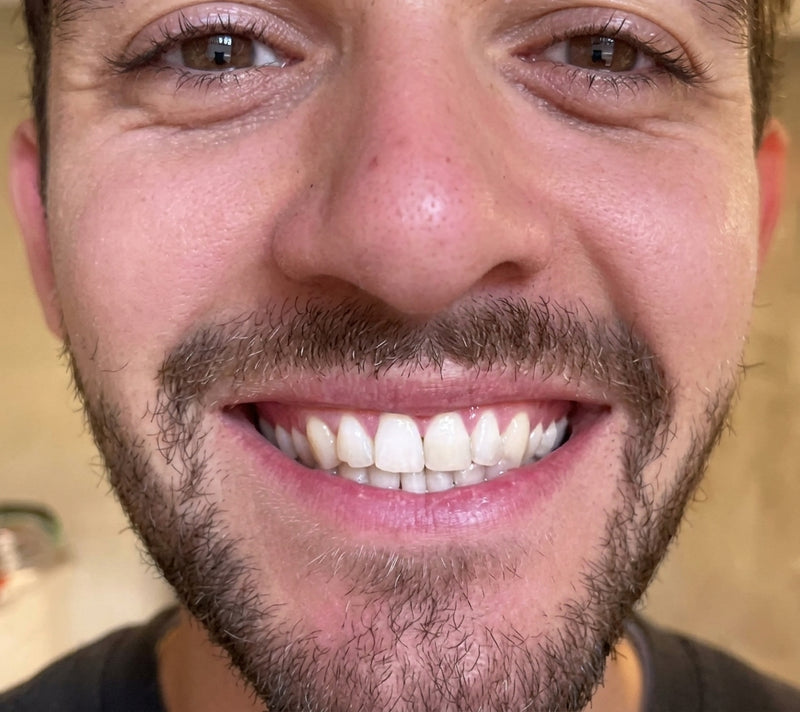 After - Temothy Re.