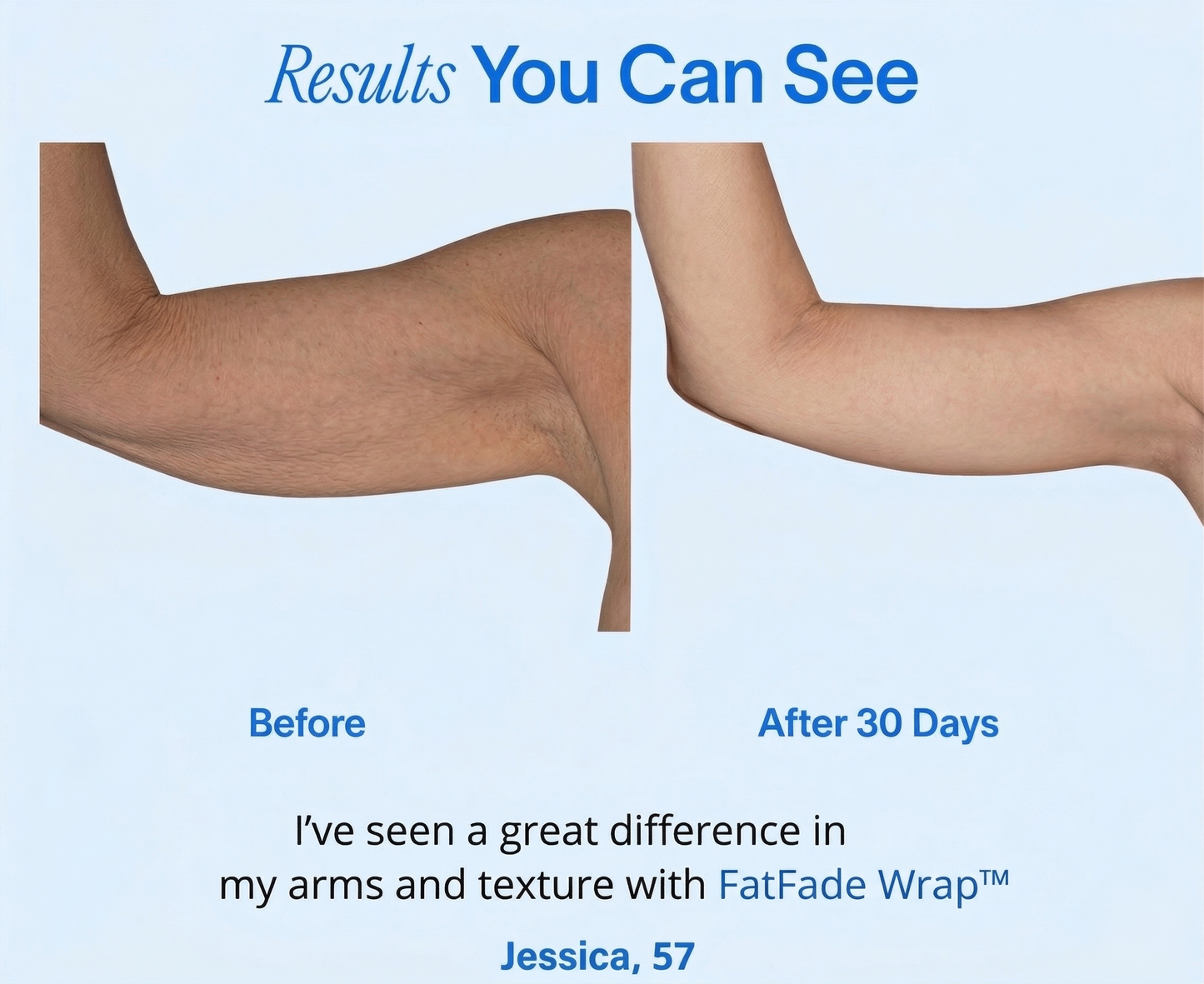 FatFade Wrap™