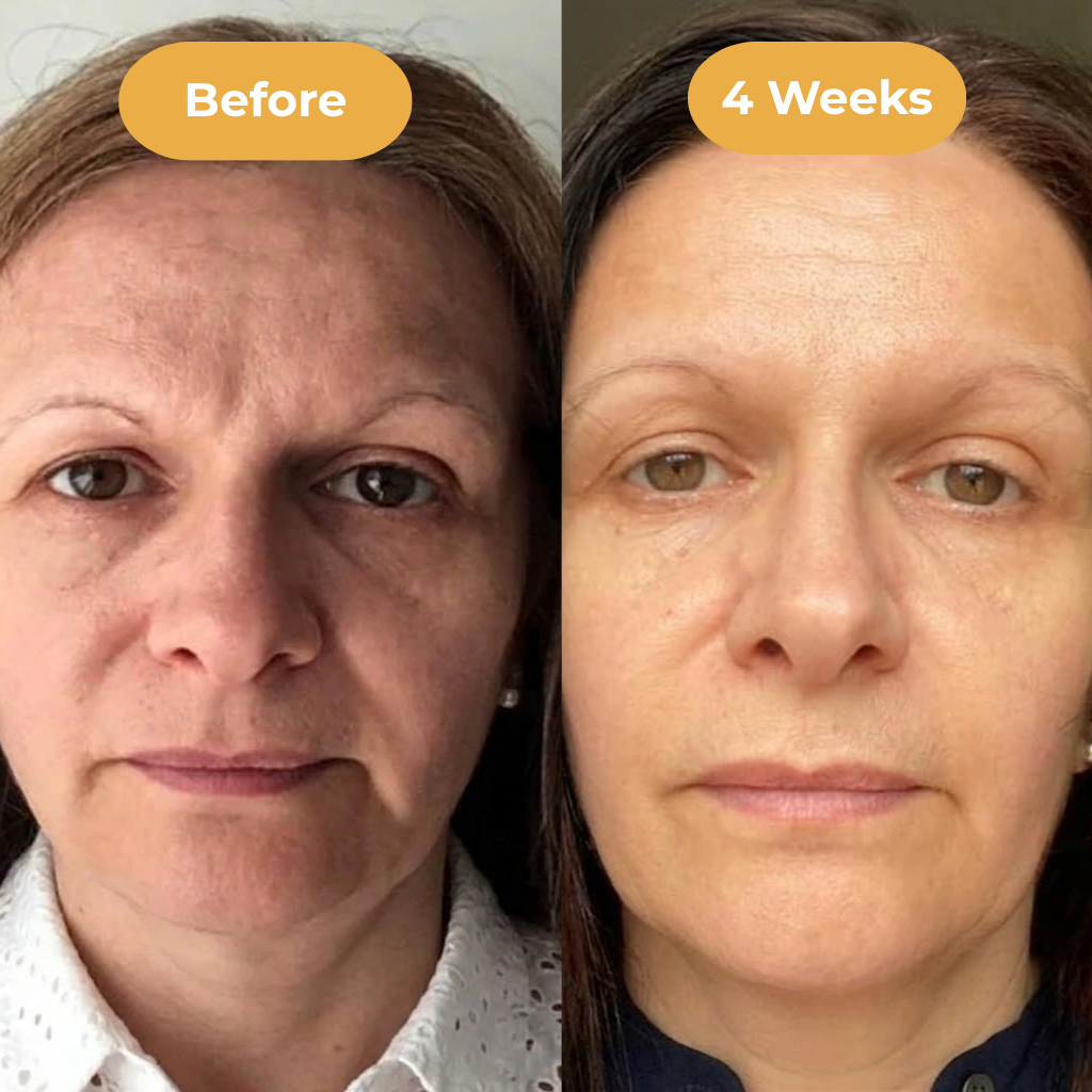AgelessSkin Serum™