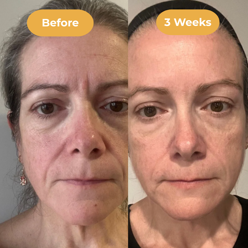 AgelessSkin Serum™