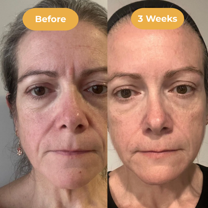 AgelessSkin Serum™