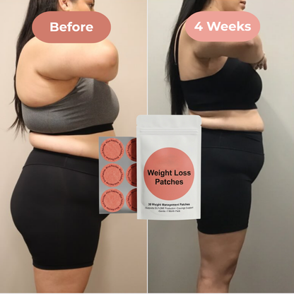 SlimShape Patches™