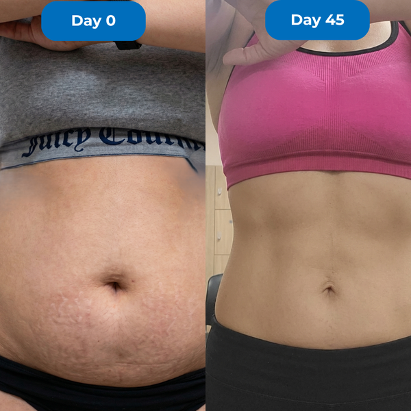 Lifts Apron Belly Postpartum
