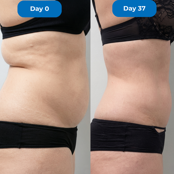 Better Than Surgery Results