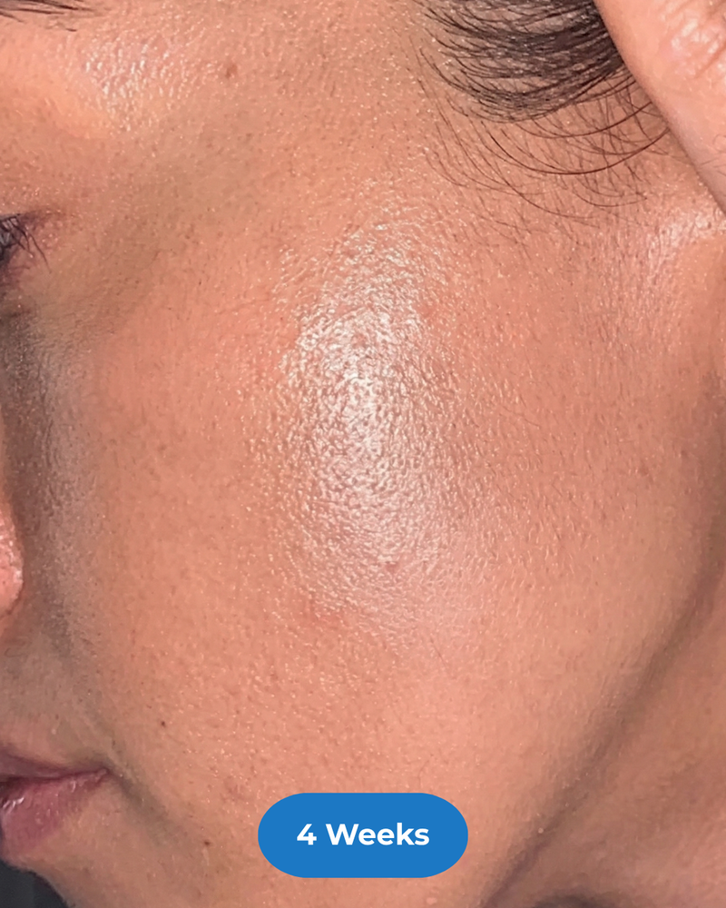 Face after treatment