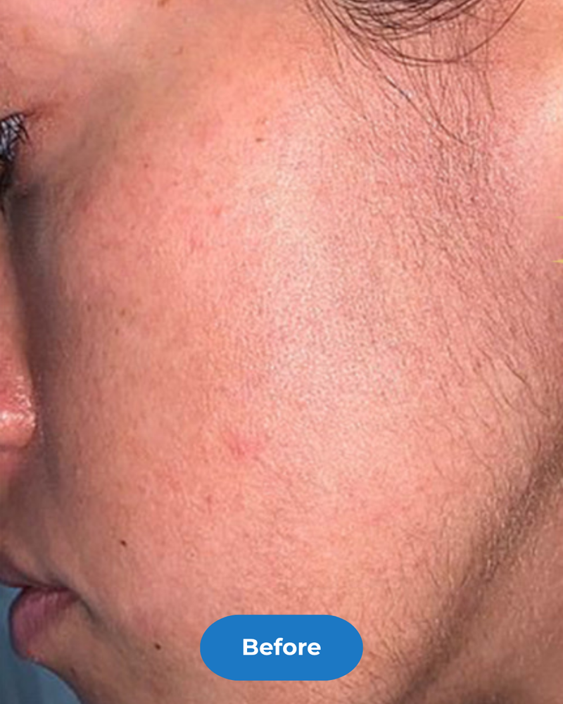 Face before treatment