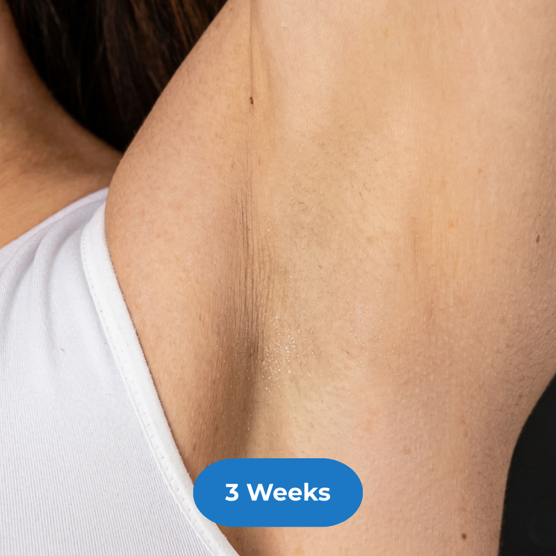 Armpits after treatment