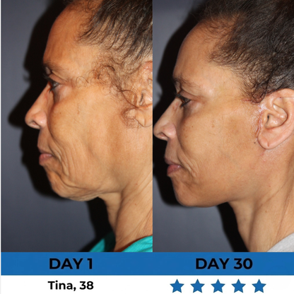 FirmLift Wand™