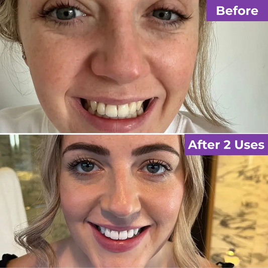 SmileUp Corrector Serum™