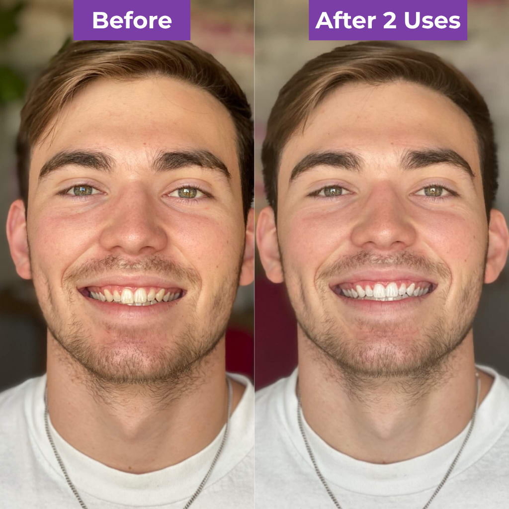 SmileUp Corrector Serum™