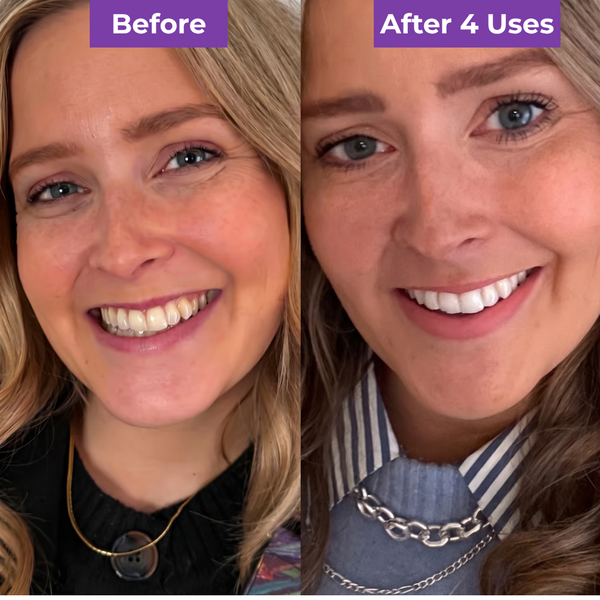 I Finally Smile in Meetings