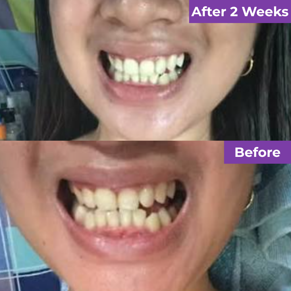SmileUp Toothbrush™