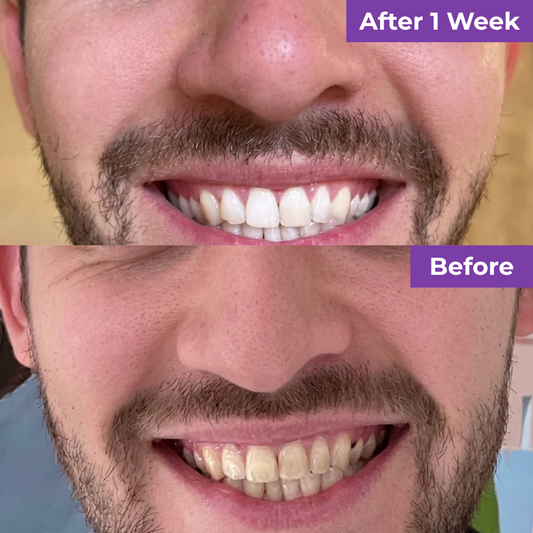 SmileUp Toothbrush™