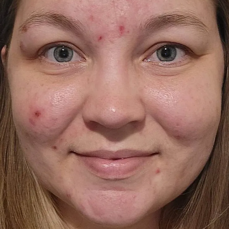 Day 0