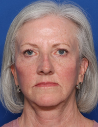 Michelle Pat.