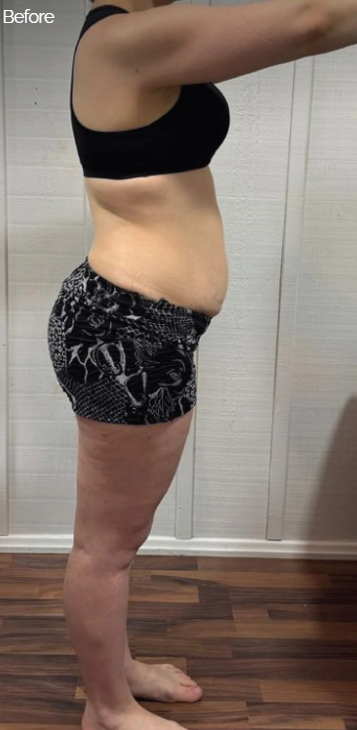 Before - Marie