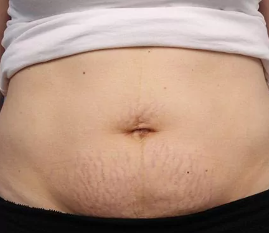Before - Mira Bo.