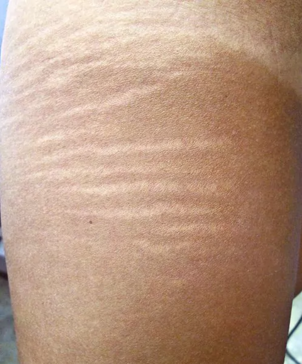 Before - Rimas Re.