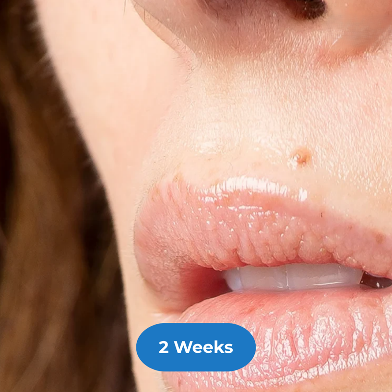 Face after treatment