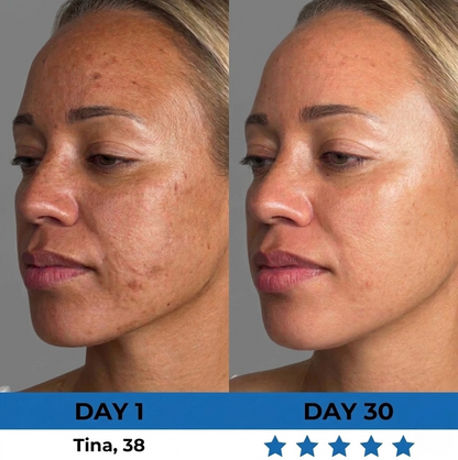 FirmLift Wand™