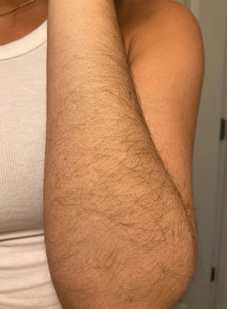 Day 0