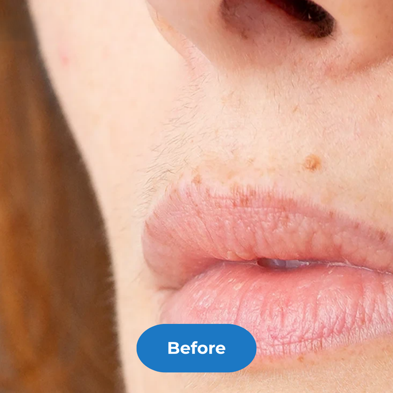 Face before treatment